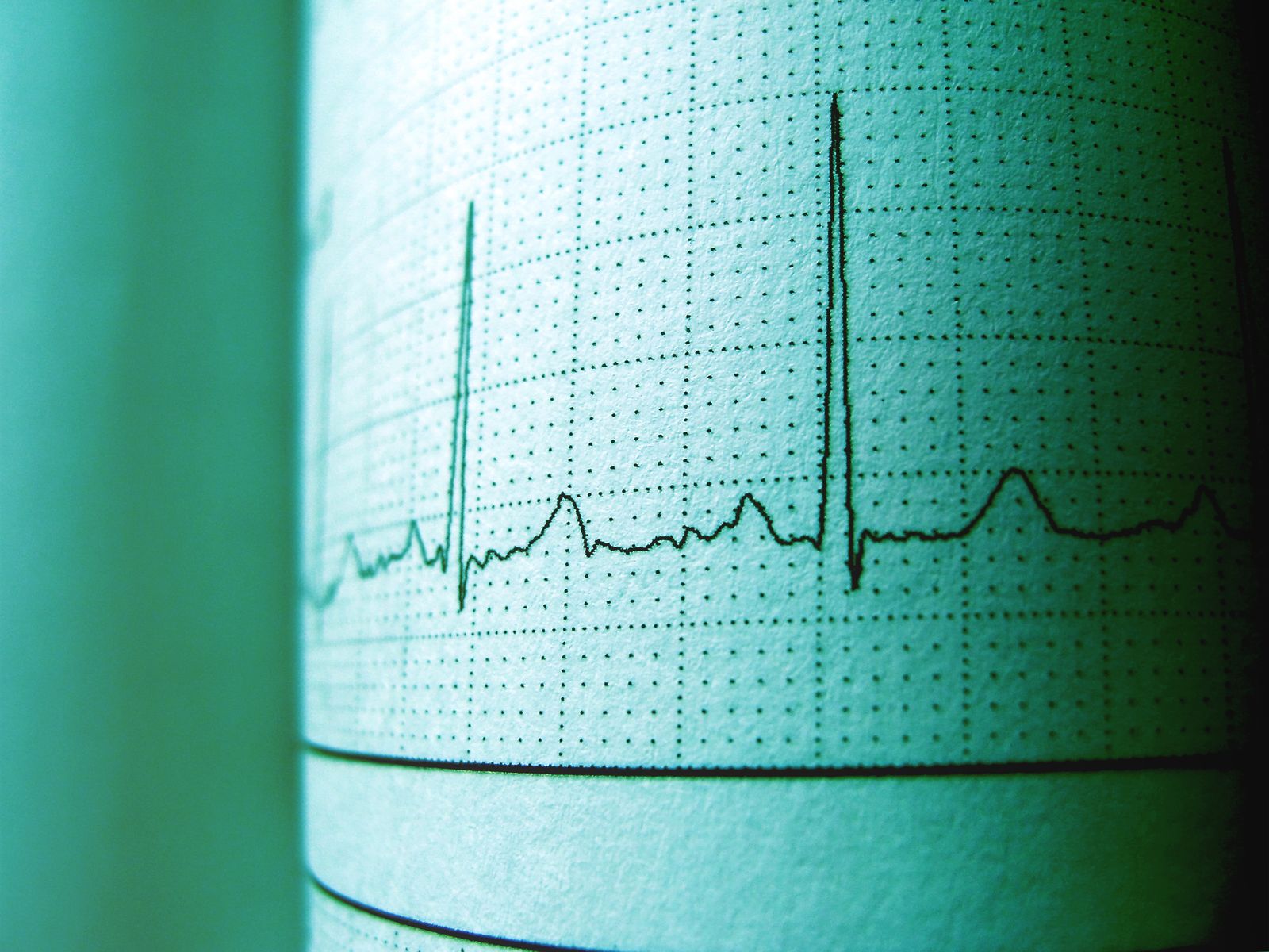 ECG & diagnostics